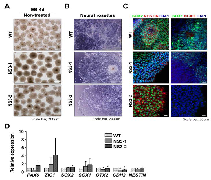 NS3 역분화 줄기세포에서 초기 신경 신경 로제트로의 발달 결함