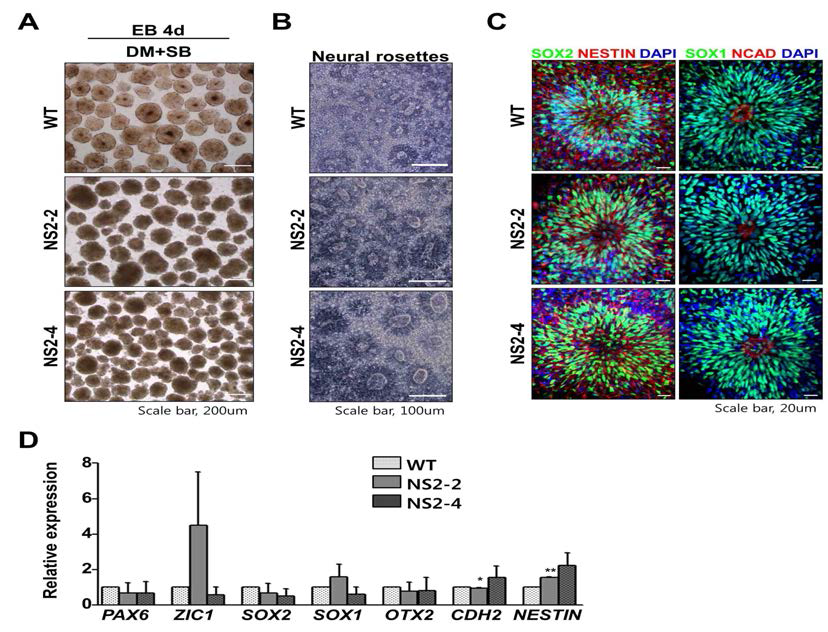 신호전달체제 조절에 의한 NS2 역분화 줄기세포의 정상적인 초기 신경 발달