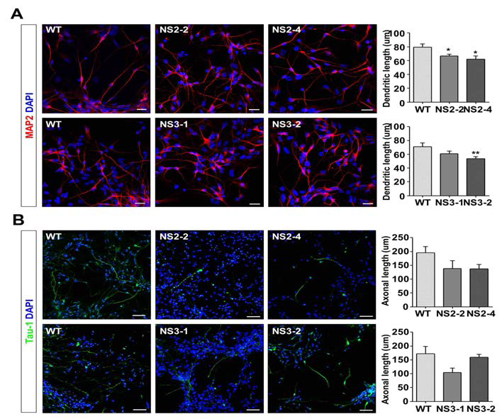 누난 증후군 환자 유래 신경세포에서 수상돌기와 축삭돌기의 길이 감소
