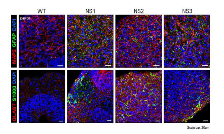 누난 증후군 환자 유래 대뇌 오가노이드에서 신경교세포 특이적 마커 발현의 증가