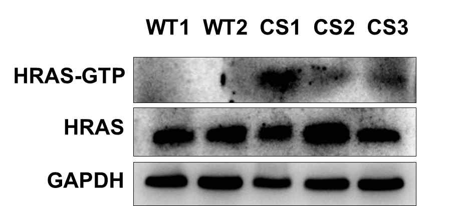 웨스턴 블롯을 통한 코스텔로 환자 중배엽 줄기세포에서의 HRAS-GTP 파악