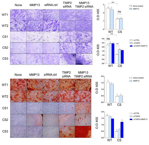 MMP13 재조합 단백질과 TIMP2 siRNA 처리를 통한 환자 골아 세포 결함 회복