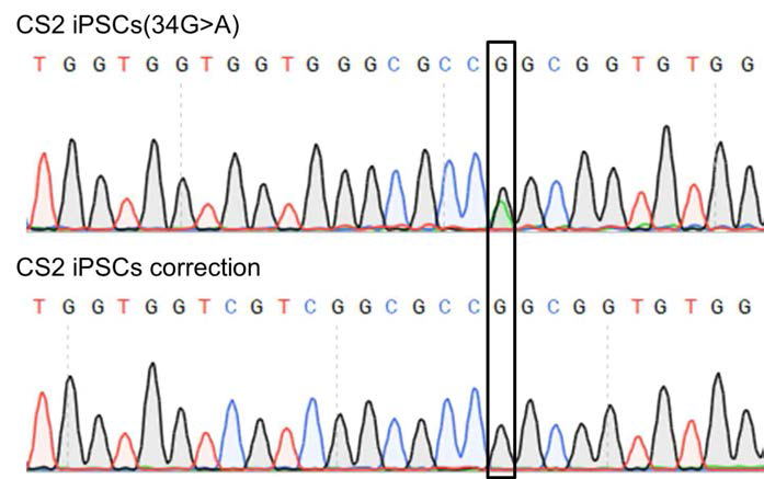 CRISPR 유전자 가위를 통한 환자 역분화 줄기세포의 정상화