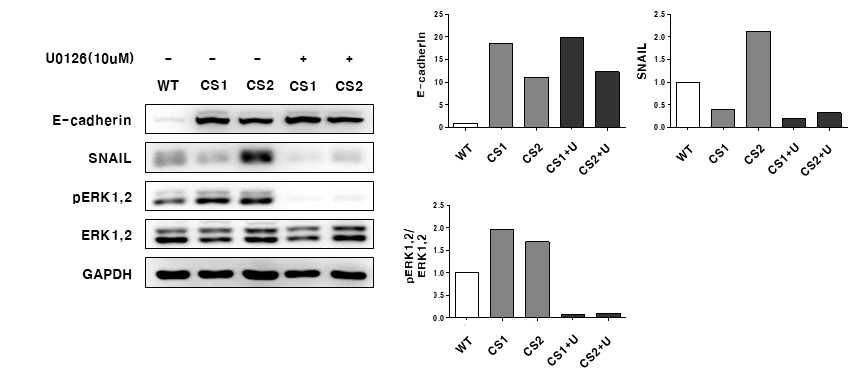 ERK1/2 억제제 처리 후 중간엽 세포 내 상피-중간엽 변이과정에 연관듼 단백질 발현
