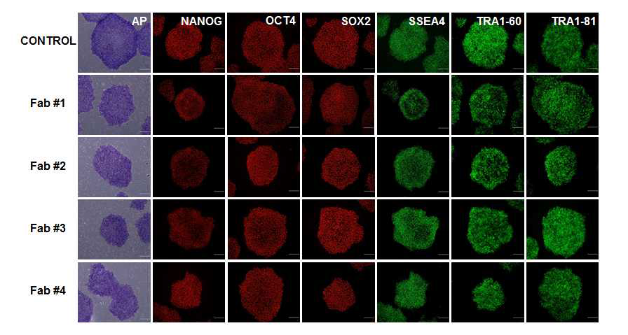새로 확립된 파브리병의 역분화 줄기세포의 전분화능 확인