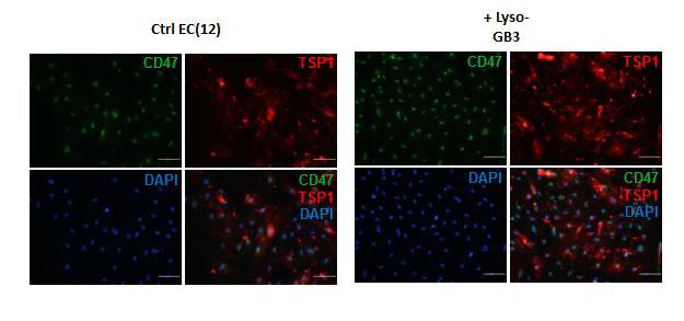 정상의 혈관내피세포에 LYSO-GB3를 처리하였을 때 나타나는 TSP1의 위치 확인