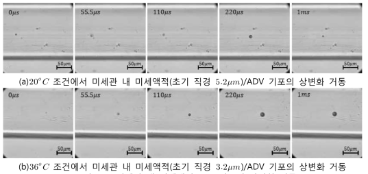 미세관 내 미세액적/ADV 기포의 상변화 거동