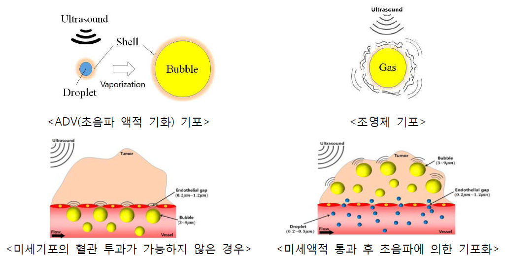 조영제 기포와 상변화 액적의 원리와 응용