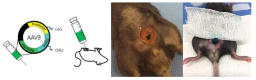 아데노바이러스 벡터를 이용한 방광 평활근의 transfection 동물모델 개발