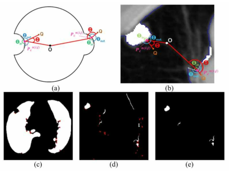 폐 외벽의 결절 발생에 의한 Segmentation 사이의 각도의 변화와 이를 이용한 폐 윤곽 검출 방법