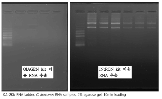 RNA 추출 후 전기영동으로 확인한 밴드 모습