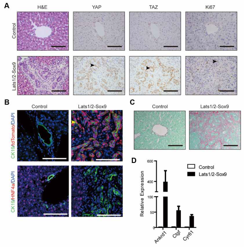 (A) 간 조직 염색 결과 (B) 형광면염역색 및 (C) 콜라겐에 대한 특수염색 결과 (D) 각 유전형 마우스간의 YAP/TAZ 타겟 유전자 mRNA에 대한 qRT-PCR 결과