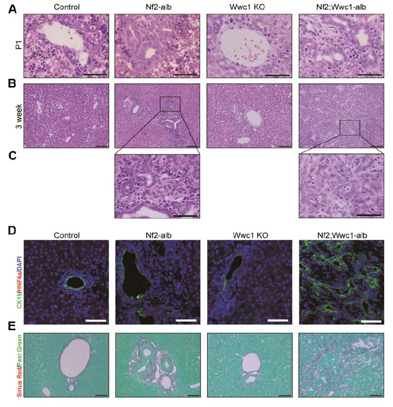 (A-C) 각 유전자 결손 마우스의 간조직 H&E 염색 결과 사진 (D) Hnf4a 와 Ck19 단백질에 대한 형광면역염색 결과 사진 (E) 특수염색 결과 사진