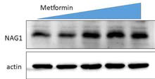 메타포민의 난소암줄기세포에 대한 NAG1발현에 미치는 영향