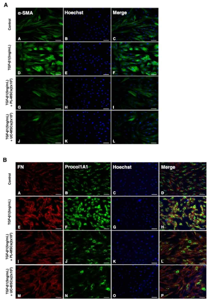태반유래 줄기세포가 human intestinal myofibroblasts에서 TGFβ1에 의해 발현된 Procol1A1, FN 및 α-SMA에 미치는 영향