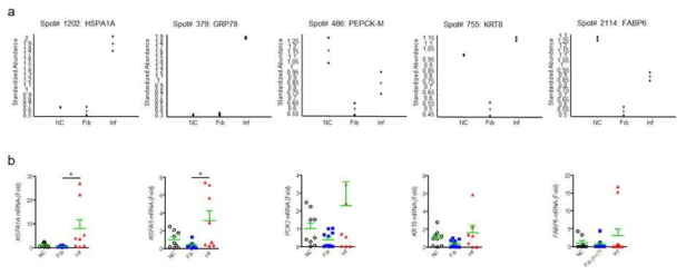 단백체학 기법을 통하여 발굴된 협착성 크론병의 biomarker candidate의 인체조직 내 mRNA 발현 정도 확인 (a. 단백체학 기법을 통한 정상[NC], 협착[Fib], 염증[Inf] 조직의 후보물질 발현 정도; b. 각 후보물질의 인체 조직 내 mRNA level)