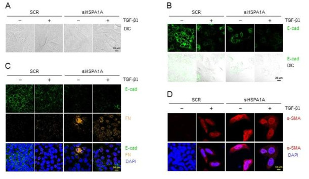 CACO2 세포주를 HSPA1A 및 HSP5-specific siRNA 로 transfection 한 뒤 TGFβ1으로 48시간 처리한 뒤 epithelial-mesenchymal transition(EMT)을 확인함