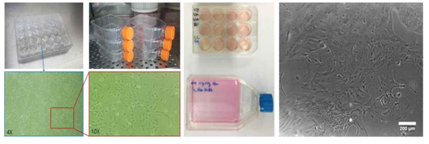 왼쪽: 혈관내피세포 배양환경 구축, 오른쪽: 성상세포 배양환경 구축