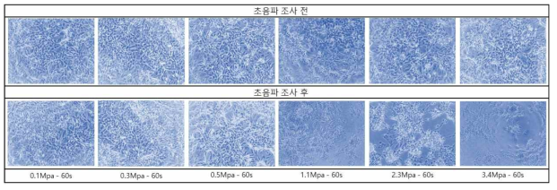 In vitro 집속초음파에너지 조건별 적용 시 세포 형태학적 변화