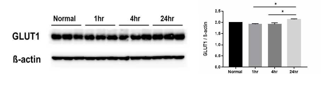 집속초음파 조사 후 1시간, 4시간, 24시간 후 GLUT1 단백질의 발현량 변화를 웨스턴 블랏으로 확인하였음.(n=3, *p<0.05)