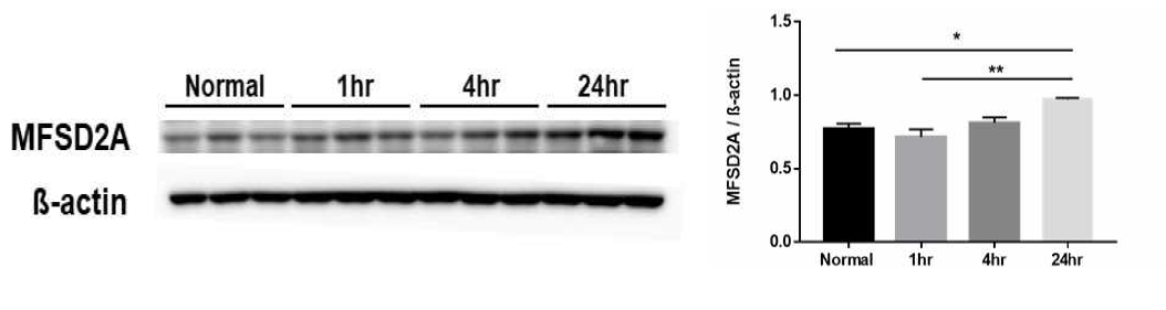 집속초음파 조사 후 1시간, 4시간, 24시간 후 MFSD2A 단백질의 발현량 변화를 웨스턴 블랏으로 확인하였음. (n=3, *p<0.05, **p<0.01)