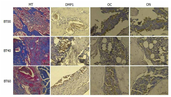 Masson’s Trichrome staining 및 immunohistochemical staining 결과. BR가 포함되지 않은 BT00에 비해 40% 함유된 BT40 및 60% 함유된 BT60에서 신생골 형성이 더 많이 된 양상이 관찰되며 광화관련유전자인 DMP1, OC, ON의 발현이 증가한 것을 관찰할 수 있음. NB: 신생골, B: 기존골