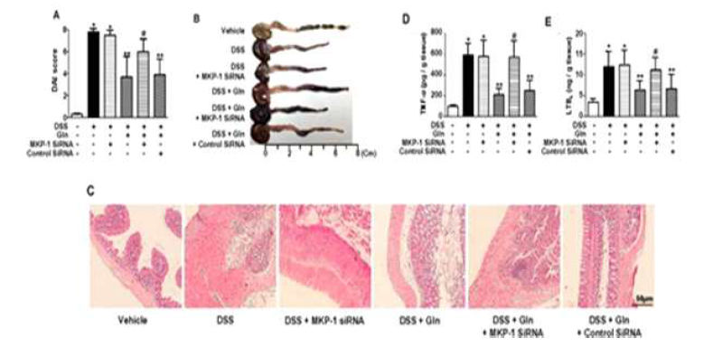 Glu ameliorates colitis via MKP-1 induction. A, Disease severity; B, the colon length on day 5; C, histological examination; D,E, colonic levels of TNF-α and LTB4