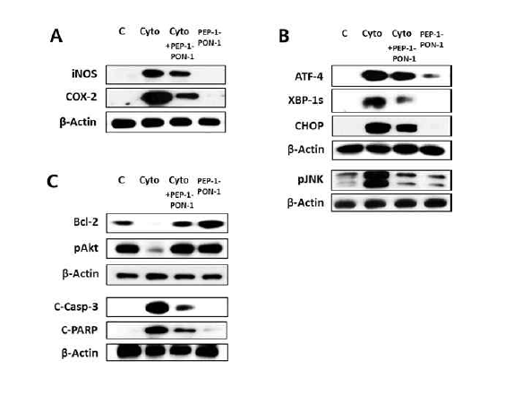 Effects of transduced PEP-1-PON1 on the levels of inflammatory mediators, ER stress proteins, and apoptosis-related proteins in cytokine-treated INS-1 cells. The levels of inflammatory mediators (A), ER stress proteins (B), and apoptosis-related proteins (C) were determined by western blotting