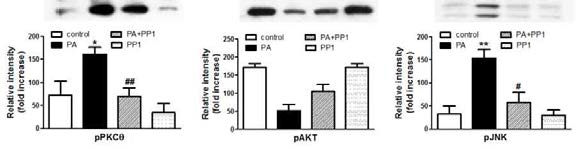 Effects of PEP-1-PON1 on the expression levels of pPKCθ(Thr538) (A), pAkt (Ser473) (B), and pJNK(Thr183/Tyr185) (C)