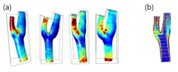 (a) 형상에 따른 정상 경동맥 내 혈유동 특성 가시화, (b) 분지관 근처 Platelet activation 현상이 일어나는 혈관 내부 형상
