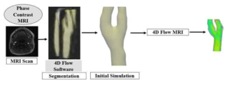 4D Flow 실험적 혈유동 가시화 기술 획득 과정