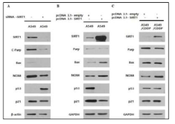 Unlike cisplatin-resistant NSCLC cells, reduced SIRT1 induced anti-apoptosis and cell cycle arrest through p53 and p21 in lung cancer cells