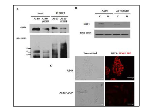 Cisplatin affects SIRT1 ubiquitination in the cytoplasm of cisplatin-resistant NSCLC cells