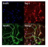 YAC128 유래 신경세포의 형태와 면역염색을 통한 신경세포 마커 확인
