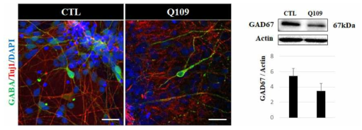 면역염색법과 western blot을 통해 GABA의 발현 정도를 확인