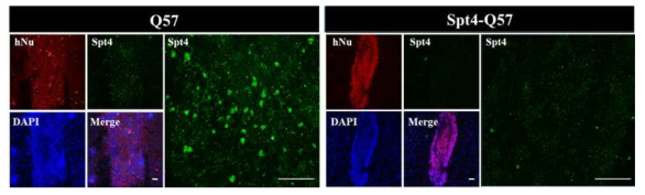 유전체 편집된 hiPSC-NPC 이식 1주 후, 이식 세포의 생존 유무와 SPT4의 발현 확인
