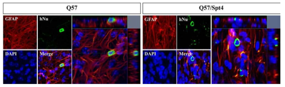 유전체 편집된 hiPSC-NPC 이식 12주 후, 형광면역염색을 통한 성상세포로의 분화 확인