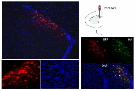 In vivo AAV biodistribution 평가: Intra-SVZ 투여