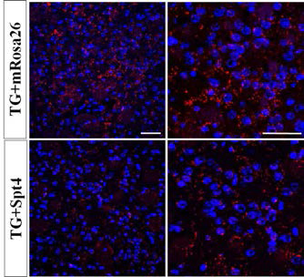 면역염색법을 이용한 mutant Htt의 발현확인 (AAV-Spt4-RFP; SVZ 투여)