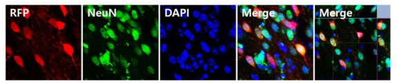 AAV-Spt4-RFP ST투여한 YAC128마우스의 Striatum에서 면역염색법을 이용하여 신경세포 내의 RFP 발현 여부 확인