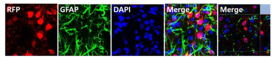 AAV-Spt4-RFP ST투여한 YAC128마우스의 Striatum에서 면역염색법을 이용하여 성상세포 내의 RFP 발현 여부 확인