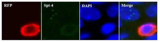 AAV-Spt4-RFP ST투여한 Q175마우스에서 면역염색법을 이용하여 RFP 발현 세포에서 Spt4의 발현의 감소 확인