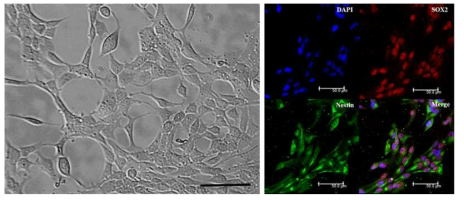 YAC128 신경줄기세포의 형태학적 특성 및 면역염색을 통한 신경줄기세포 마커 발현 여부 확인