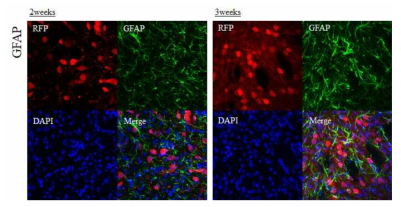 AAV r3.45-mRosa26-RFP 주입 2주 또는 3주 후, astrocyte에서 AAV가 발현되지 않음