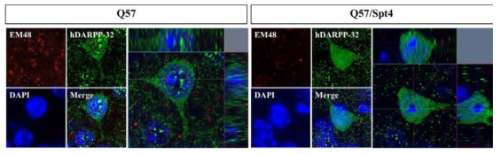 이식 12주 후, 형광면역염색을 통한 mutant huntingtin protein의 발현 유무 확인