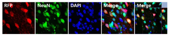 면역염색법을 이용하여 신경세포 내의 RFP 발현 여부 확인