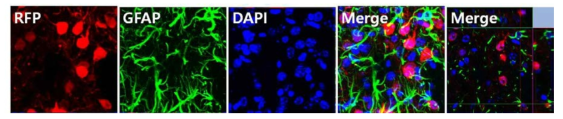 면역염색법을 이용하여 성상세포 내의 RFP 발현 여부 확인