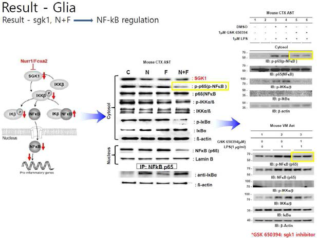 SGK1 발현 변화와 NF-kB 신호전달체계화의 연관성 규명
