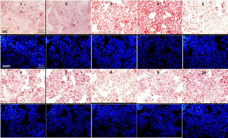 Inhibitory effects of compounds 1, 3, 4, 11 and 13 on the palmitate and glucose-induced lipid accumulation using oil red O and DAPI staining method