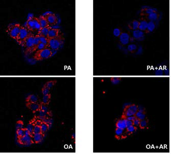 NASH 유도된 HepG2 세포에서 오라노핀 투여로 인한 lipid droplet 변화 확인